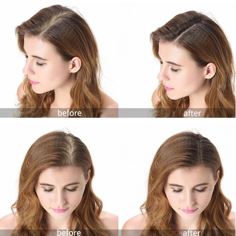 PURC Ginger Hair Growth Products Fast Growing Spray Hair Loss Treatment Oil Beauty Health Hair Care for Men Women 30ml