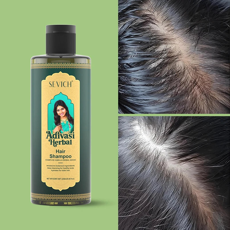 SEVICH Herbal Hair Growth Oil Set Ayurvedic Fast Hair Regrowth Thicken Serum India Adivasi Anti Hair Loss Hair Care...