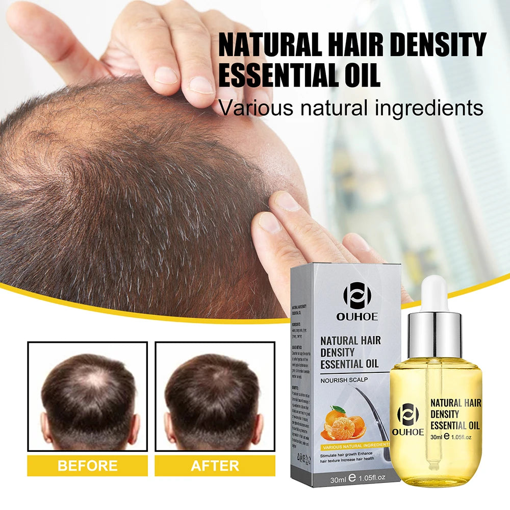 Natural Hair Growth Essential Oil Ginger Essence Hair Regrowth Thicken Hair Treatment Anti Hair Loss Gift Set For Men...