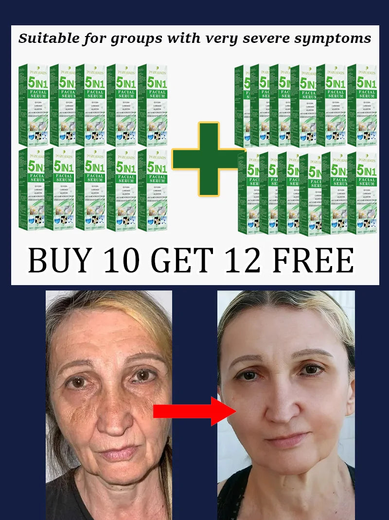 Smooth Out the Traces of Time Nᵒ Wʳⁱⁿᵏˡᵉˢ