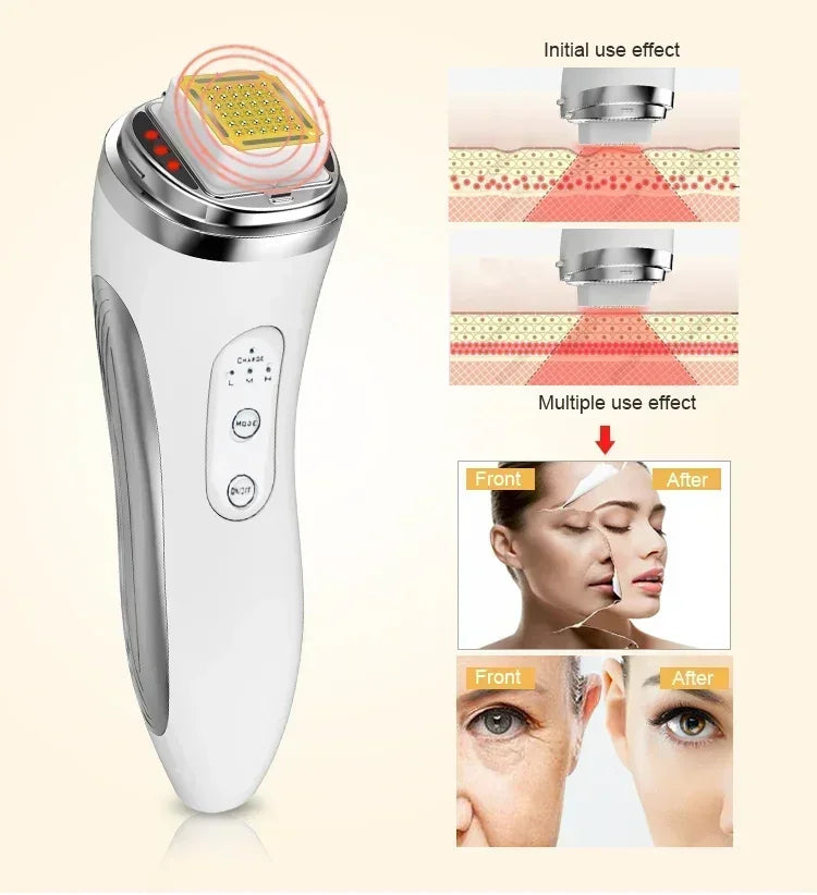 NEW RF Face Lifting Machine Anti Aging Skin Tightening Beauty Device Facial Anti Wrinkle Face Firming Eyes Neck Wrinkle Remover