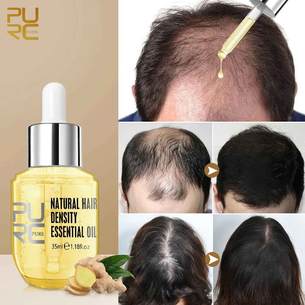 PURC Ginger Hair Growth Oil Hair Loss Treatment Fast Regrowth Serum Beauty Health Hair Growth Products for Men Women