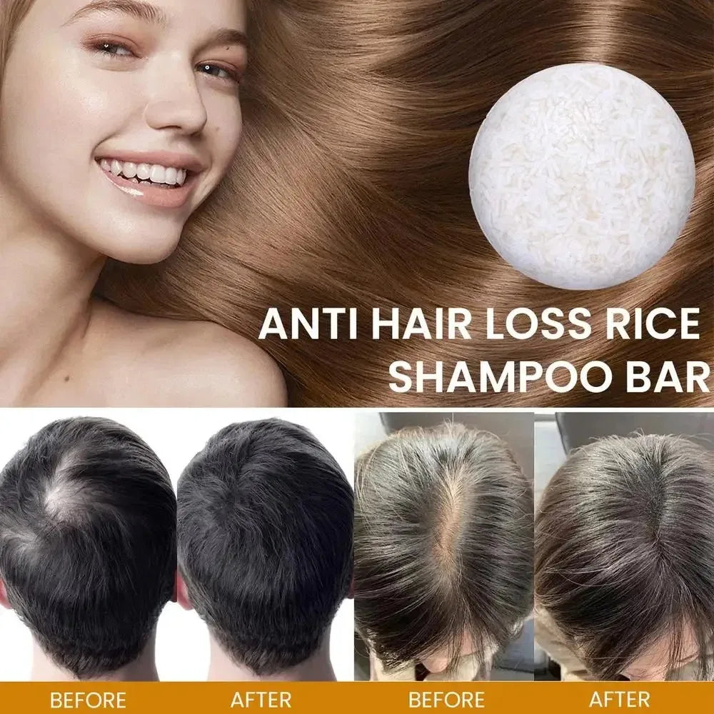 Organic Rice Shampoo Soap Bar Oil Free Conditioning Soap Rice Water Protein Nourishing Anti-loss Hair Hair Growth Soap Bar - Kimlud