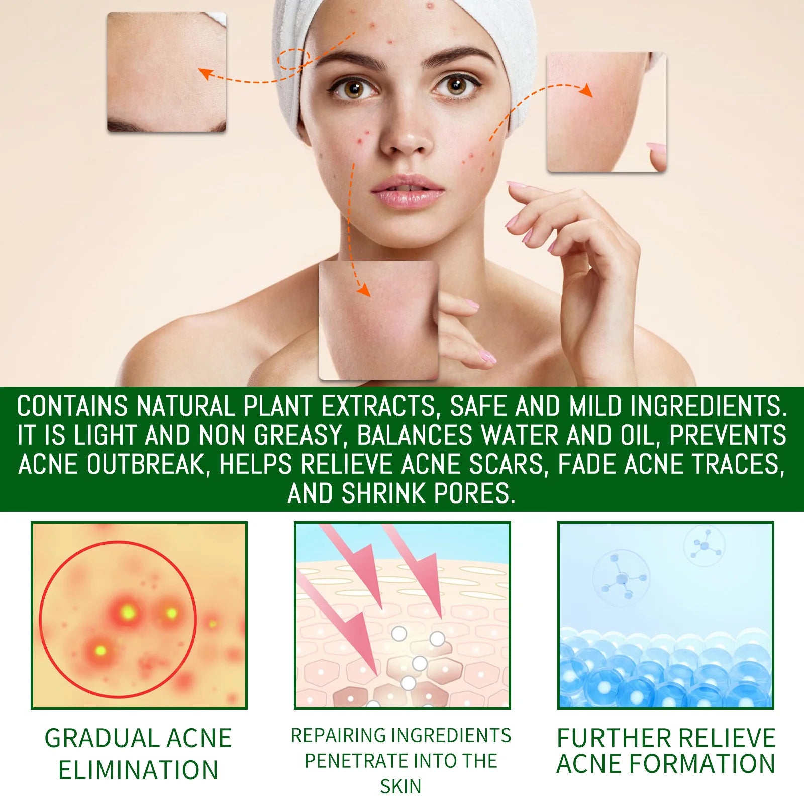 Salicylic Acid Anti Acn-e Face Serum Hydrating Fader Acne Mark Pimple Blackhead Removal Shrink Pores Oil Control Facial...
