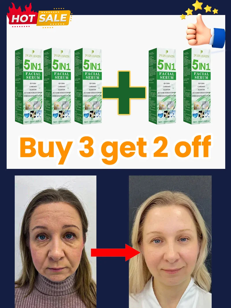 Smooth Out the Traces of Time Nᵒ Wʳⁱⁿᵏˡᵉˢ