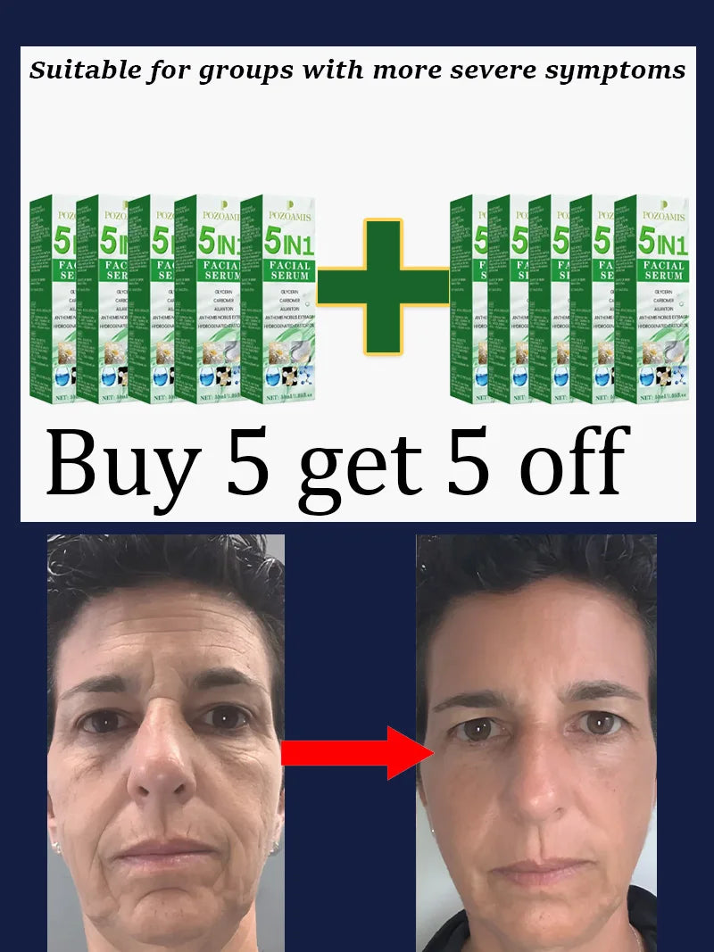 Smooth Out the Traces of Time Nᵒ Wʳⁱⁿᵏˡᵉˢ