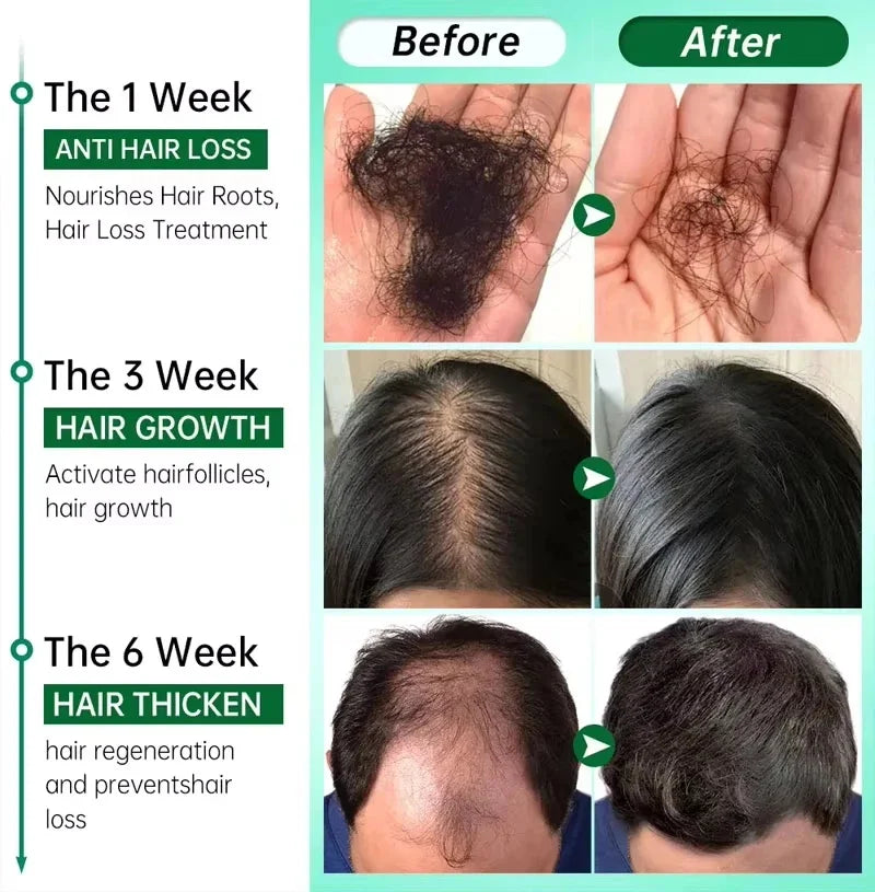 Hair Growth Serum 7 Days Fast Regrowth Essential Capsule Anti Hair loss Baldness Repair Damaged Scalp Treatment For Women Men