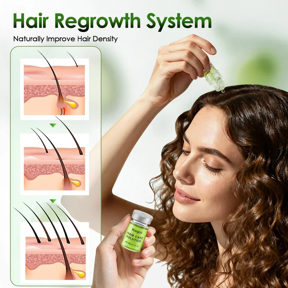 Hair Essential Care Serum Strengthen Roots Reducing Loss Prevent Baldness Nourish Scalp Hair Care Anti-Hair Loss Conditioner - Kimlud