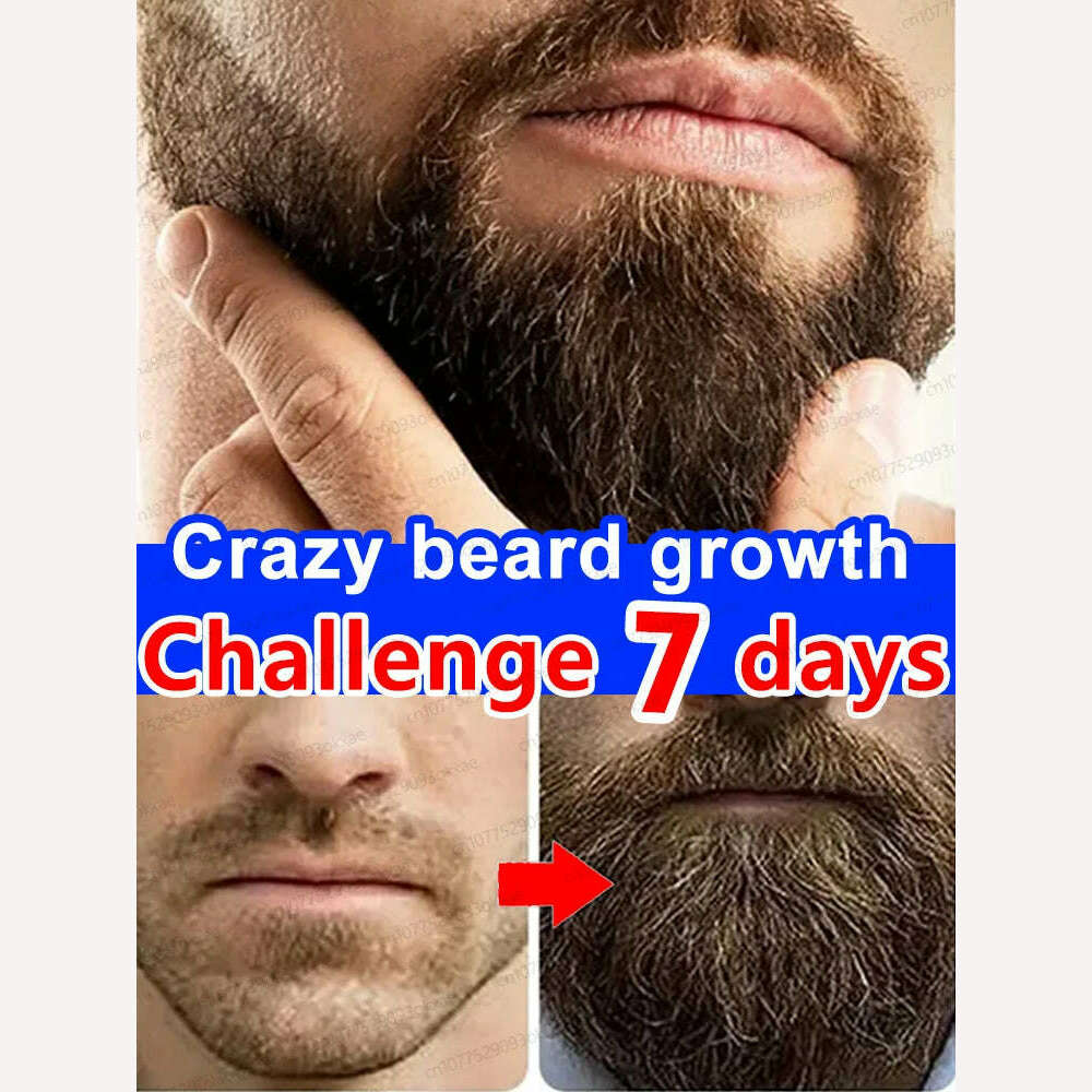 Beard Growth Serum quickly thickens and softens beards for longer, fuller beards