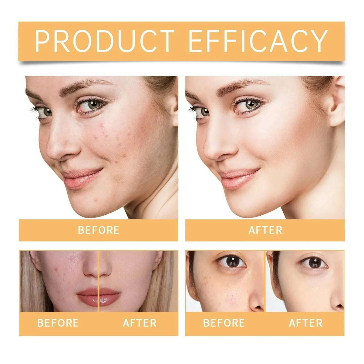 Glycolic 7% Toner 100ML Ordinary Glycolic 7% Toner Remove Acne, Acne Marks, Removing Acne, Repairing And Rejuvenating Skin 100ml