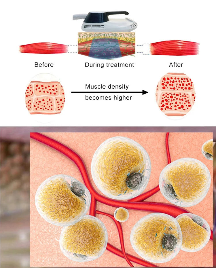 Hot Selling Professional High Frequency Shaping Body Whole Body Muscle Lifting Tightening Beauty Medical Machine