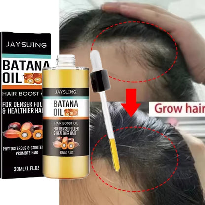 Fast Hair Growth Set Batana Oil Traction Alopecia Hair Mask Anti Break Loss Hair Growth Oil Baldness Treatment Hair...