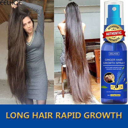 Ginger Hair Growth spray Anti Hair Fall Hair Loss Treatment Hair Growth Essence Oil for Men Women hair treatment - Kimlud