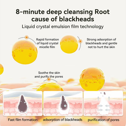LANBENA Blackhead Remover Pore Cleaner Nose Strips With 60Pcs Paper For All Skin Stype Nose Mask