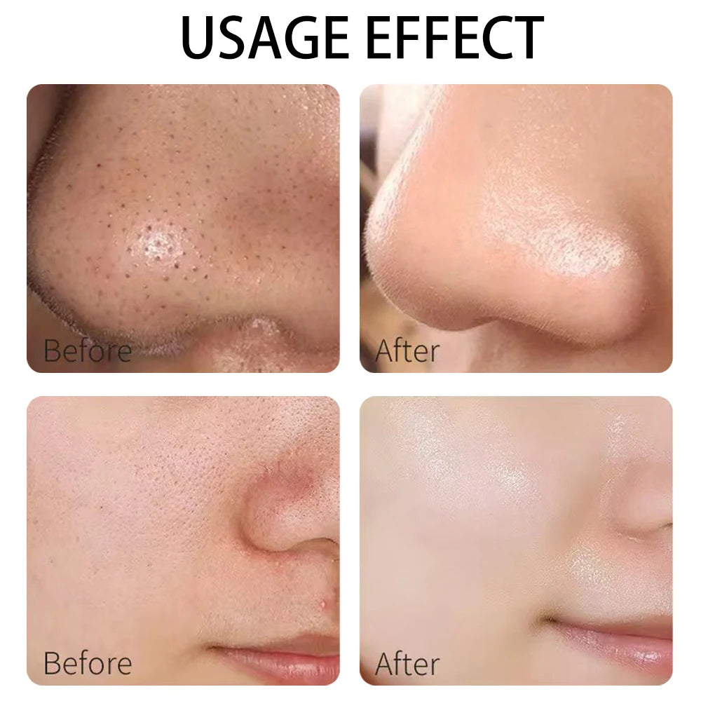 A variety of clay masks, green tea, turmeric, Dead Sea mud, whitening and hydrating, deep cleansing of pores, oil control and mo