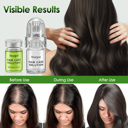 Hair Essential Care Serum Strengthen Roots Reducing Loss Prevent Baldness Nourish Scalp Hair Care Anti-Hair Loss Conditioner - Kimlud