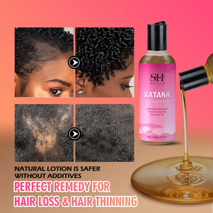 Batana Hair Growth Shampoo Conditioner Set Anti Hair Loss Treatment for Men Women Fast Thicken Regrowth Oil Beauty...