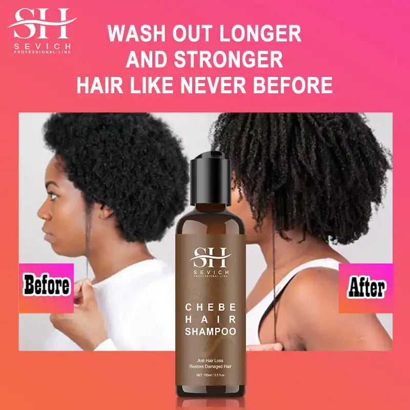 CHEBE Hair Growth Shampoo Conditioner Set Anti Hair Loss Treatment for Men Women Fast Thicken Regrowth Oil Beauty Health...