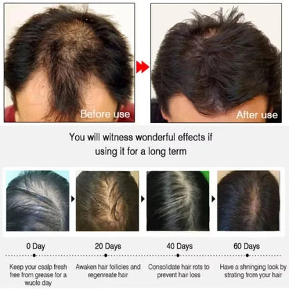 Hair Growth Serum 7 Days Fast Regrowth Essential Capsule Anti Hair loss Baldness Repair Damaged Scalp Treatment For Women Men