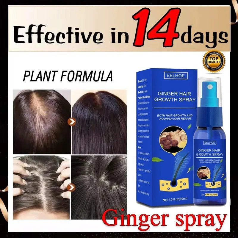 Ginger Hair Growth spray Anti Hair Fall Hair Loss Treatment Hair Growth Essence Oil for Men Women hair treatment - Kimlud