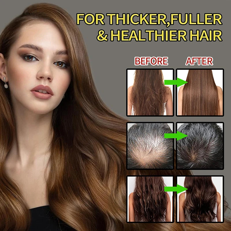 Batana Oil For Scalp And Hair Care, Palm Oil Enriched, Plant Extracts, Scalp And Hair Care Product | Kimlud Mid Range Batana