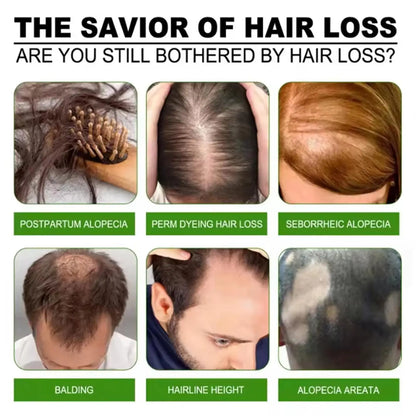 Fast Hair Growth Set Batana Oil Traction Alopecia Hair Mask Anti Break Loss Hair Growth Oil Baldness Treatment Hair...