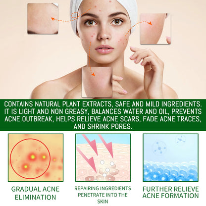 Salicylic Acid Anti Acn-e Face Serum Hydrating Fader Acne Mark Pimple Blackhead Removal Shrink Pores Oil Control Facial...