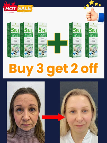 Smooth Out the Traces of Time Nᵒ Wʳⁱⁿᵏˡᵉˢ