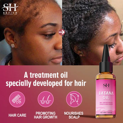 Sevich 100% Batana Oil And Scalp Massager Comb Tool Set Anti-Hair Loss Treatment Hair Growth Oil Scalp Hair...