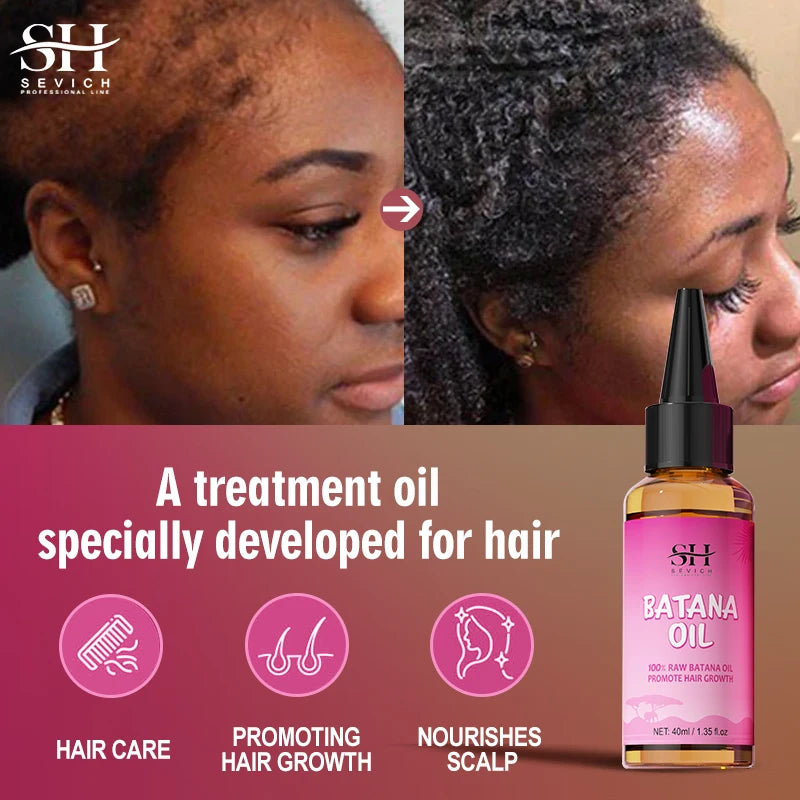 Sevich 100% Batana Oil And Scalp Massager Comb Tool Set Anti-Hair Loss Treatment Hair Growth Oil Scalp Hair...
