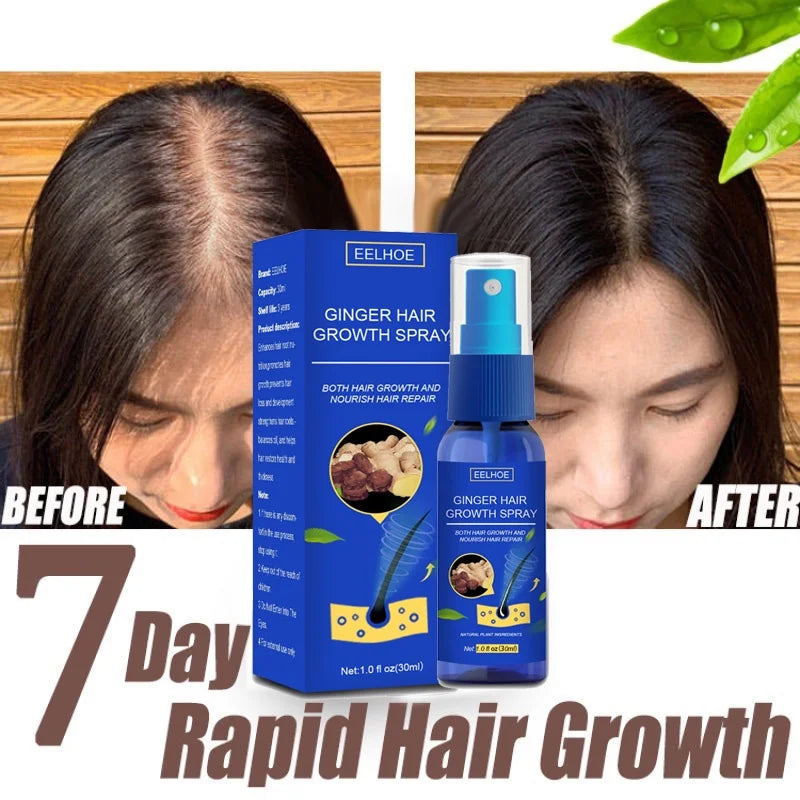 Ginger Hair Growth spray Anti Hair Fall Hair Loss Treatment Hair Growth Essence Oil for Men Women hair treatment - Kimlud