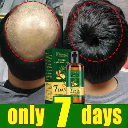 Hair Growth Serum 7 Days Fast Regrowth Essential Capsule Anti Hair loss Baldness Repair Damaged Scalp Treatment For Women Men