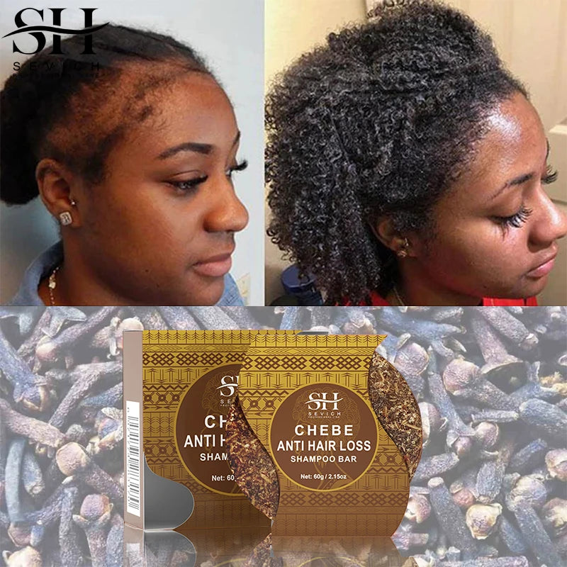 Fast Hair Growth Oil African Crazy Traction Alopecia Chebe Hair Mask Anti Hair Break Hair Strengthener Hair Loss Treatment Spray