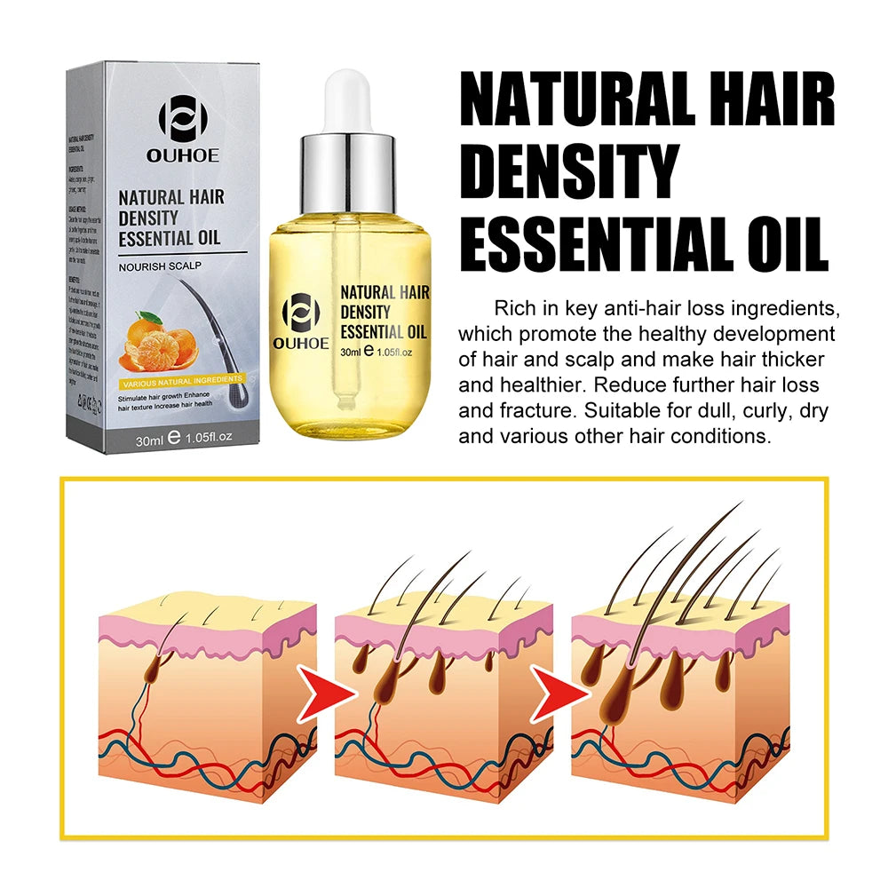 Natural Hair Growth Essential Oil Ginger Essence Hair Regrowth Thicken Hair Treatment Anti Hair Loss Gift Set For Men...