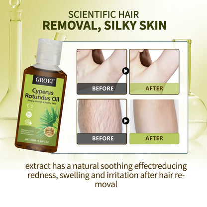 Hair Growth Inhibitor Gel Painless Depilatory - For underarms, legs & arms with skin-friendly base oils. Beauty skincare...