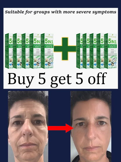 Smooth Out the Traces of Time Nᵒ Wʳⁱⁿᵏˡᵉˢ