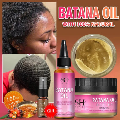 100% Batana Hair Fast Growth Oil Set African Crazy Traction Alopecia Batana Hair Mask Anti Hair Break Hair Regrowth...