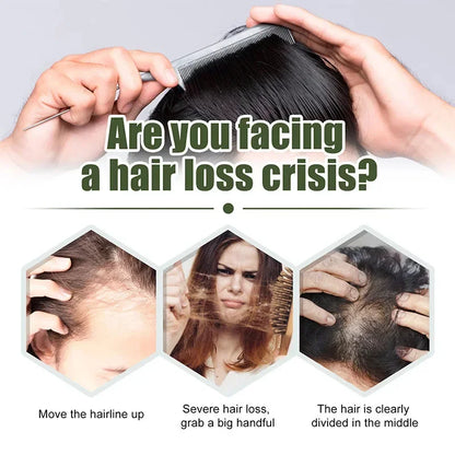 Hair Growth Oil Africa Crazy Traction Alopecia Serum Anti Hair Break Thicken Hair Loss Treatment Spray for Man Women 60ML