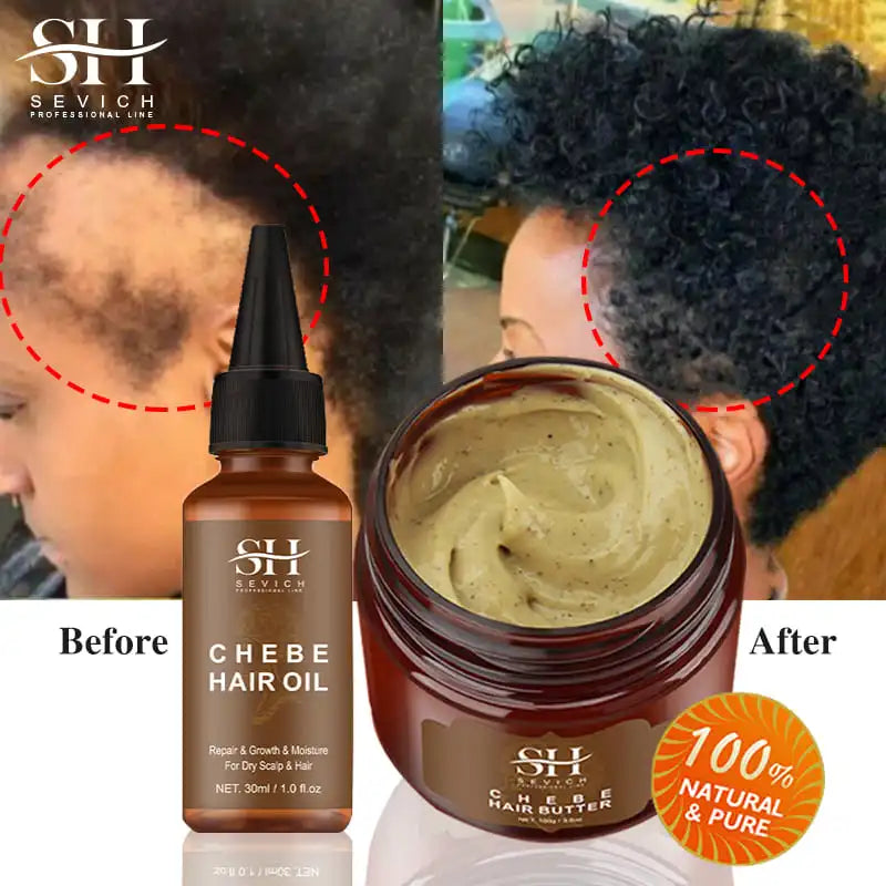 Fast Hair Growth Oil African Crazy Traction Alopecia Chebe Hair Mask Anti Hair Break Hair Strengthener Hair Loss Treatment Spray