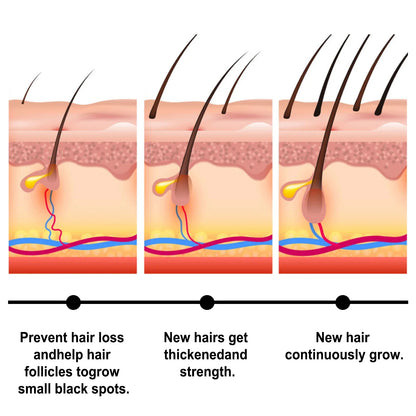 Fast Hair Growth Set Batana Oil Traction Alopecia Hair Mask Anti Break Loss Hair Growth Oil Baldness Treatment Hair...