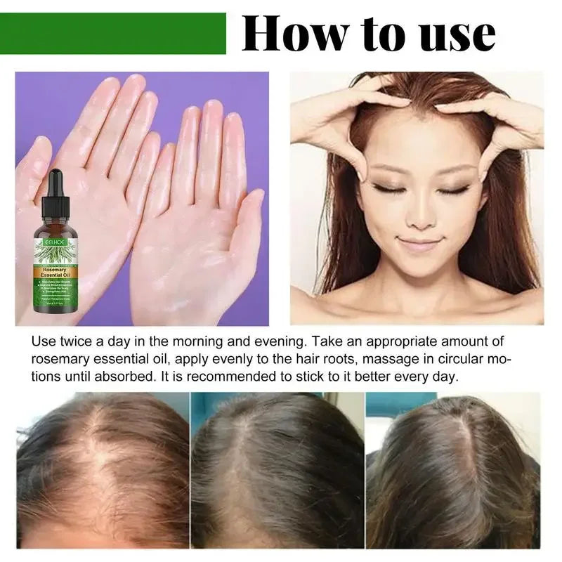 Rosemary Essentiall Oil Hair Growth Products Organic Products Scalp Hair Strengthening Oil For Nourish Shiny Healthy |...