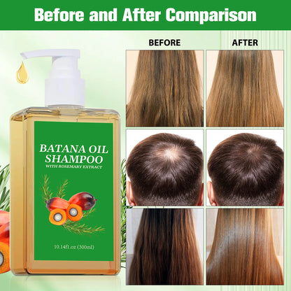 Batana Oil Shampoo & Conditioner Set Hair Strengthens Anti Loss Restore Damaged Cleansing Dandruff Control Hair Growth...
