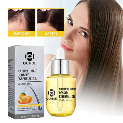 Natural Hair Growth Essential Oil Ginger Essence Hair Regrowth Thicken Hair Treatment Anti Hair Loss Gift Set For Men...