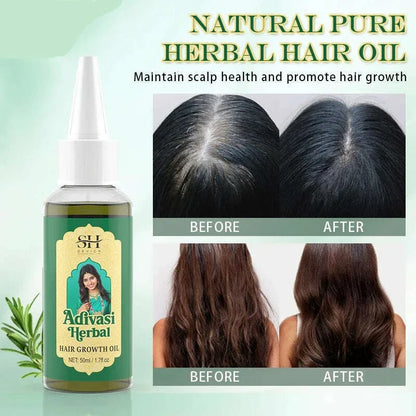 Ayurvedic Hair Growth Oil India Adivasi Herbal Hair Oil Rosemary Anti Hair Loss Fast Regrowth Thicken Oils Hair Growth Products
