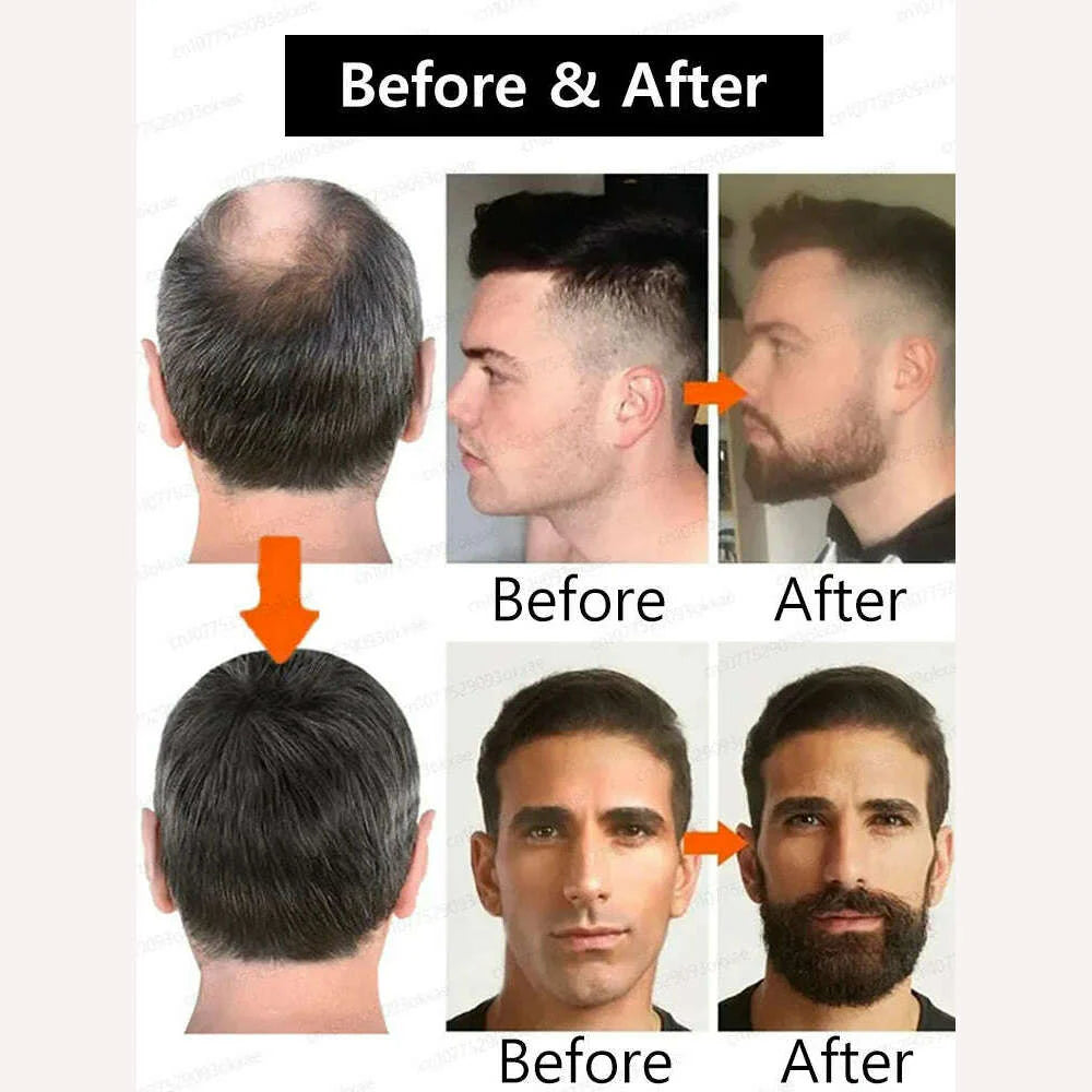 Beard Growth Serum quickly thickens and softens beards for longer, fuller beards