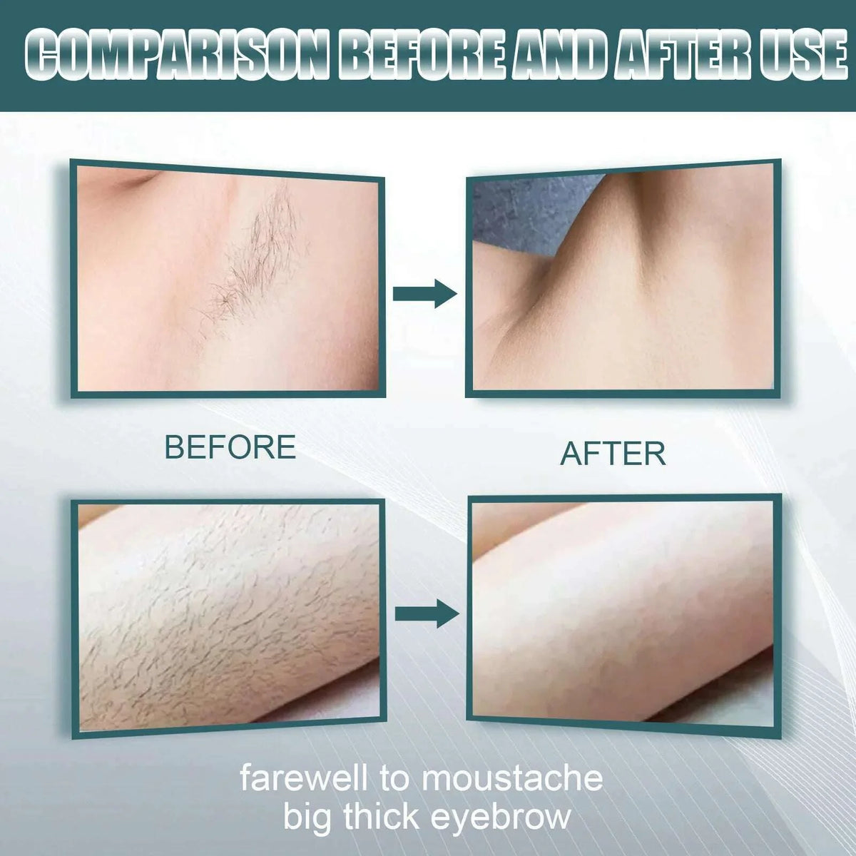 Men Hair Remover Cream Inhibition Hair Growth Eliminate Beard Armpit Chest Private Parts Gently Depilatory Painless Remover